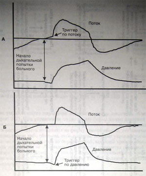 Триггер вдоха по потоку (А) и по давлению (Б). 