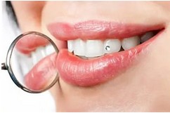 Лечение зубов без пломб
